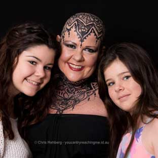 Keryn Barnett is Living with Triple Negative Breast Cancer